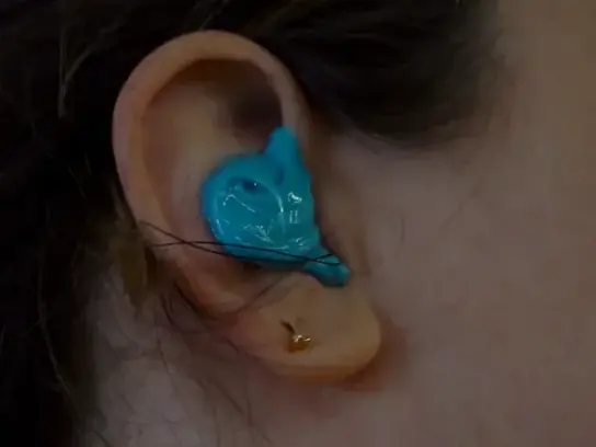 The finished impression captures the exact shape of the ear