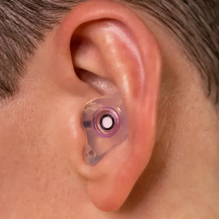 A clear Big Ear custom earplug sealed flush in the ear, filter visible