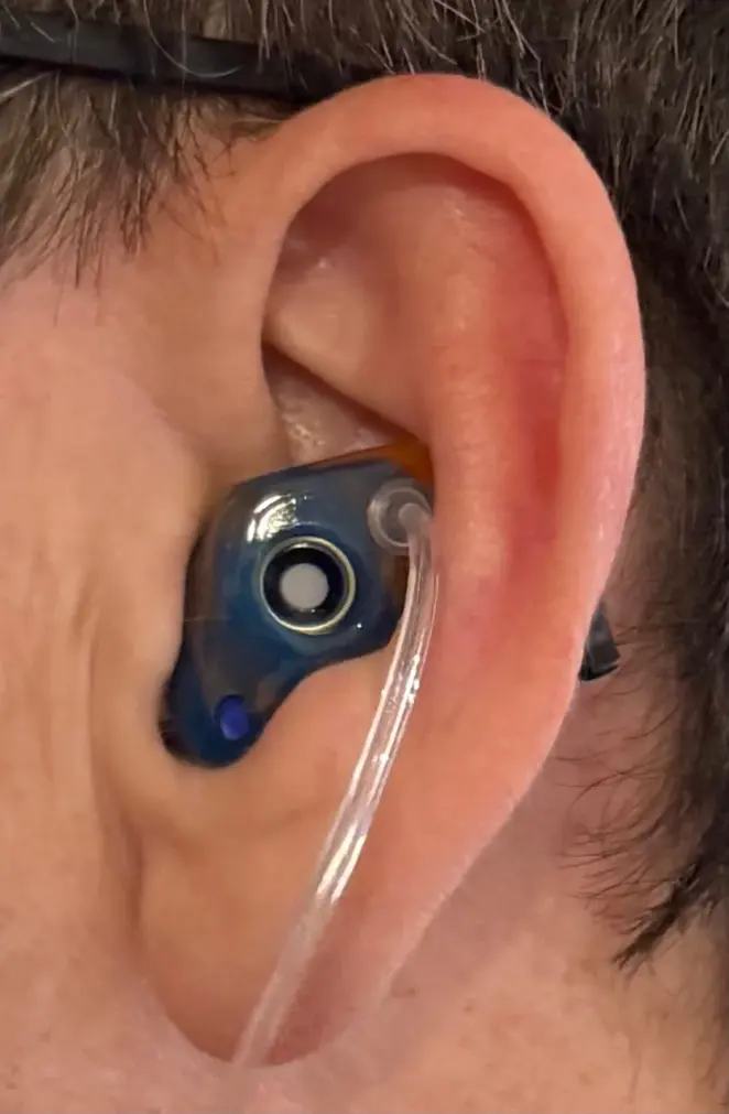 A customer wearing a blue and amber swirl custom The One filtered earplug